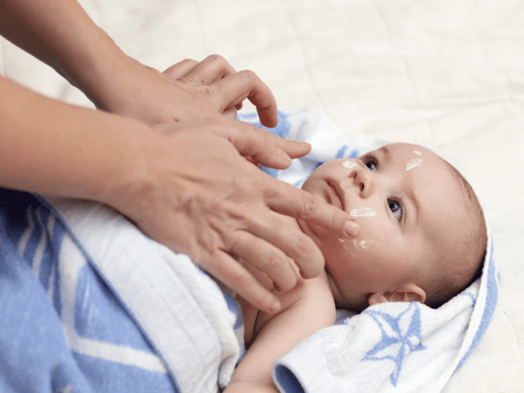 tips untuk ibu bapa jika anak mengalami ekzema