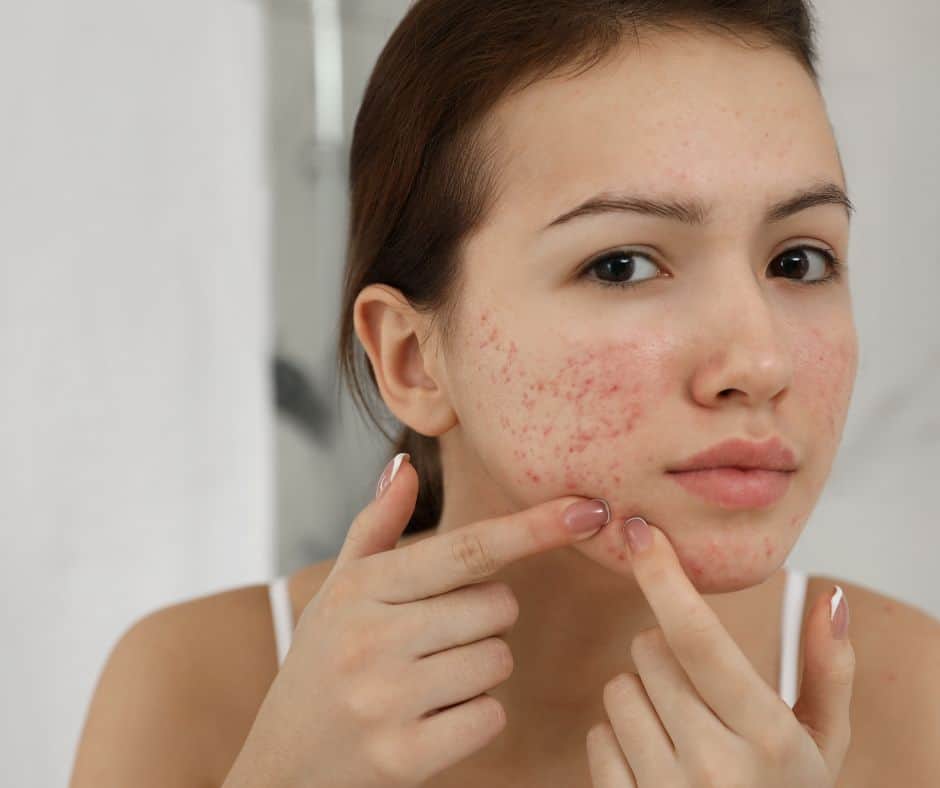 Tips for glowing skin